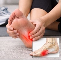 足底腱膜炎のイメージ写真