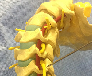 頸椎の模型